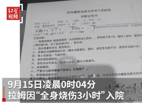 全身85%烧伤女孩结婚了